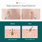 MR.GREEN Acne Remover Needles Blackhead Removal Pimple